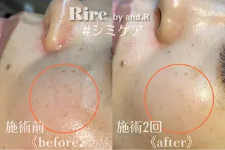 実方 梨々花のエステ・リラクイメージ