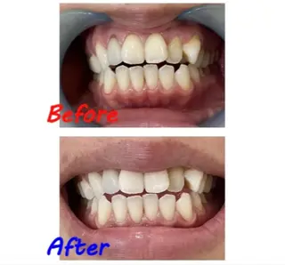 セルフホワイトニングサロン　ラヴィアン所属・ホワイトニングサロン La vie enのその他イメージ