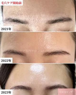 毛穴ケア専門サロン Amélio Beauté所属・毛穴ケア専門サロン アメリオボーテのその他イメージ