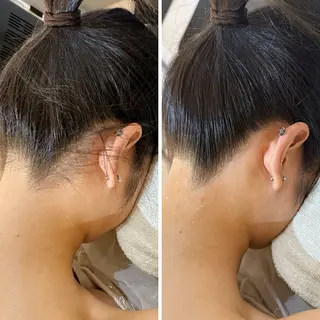 うなじ脱毛/美肌脱毛 LABELのエステ・リラクイメージ