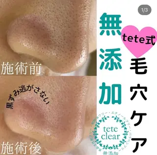 【毛穴専門店】 瑞江|yukaのエステ・リラクイメージ