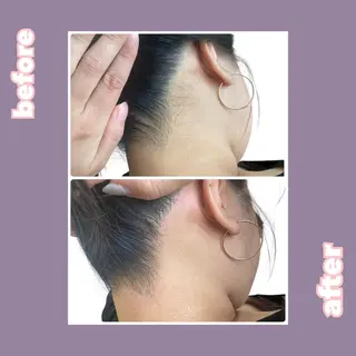 【痩身・脱毛サロン】 REBISKIN🌱のエステ・リラクイメージ