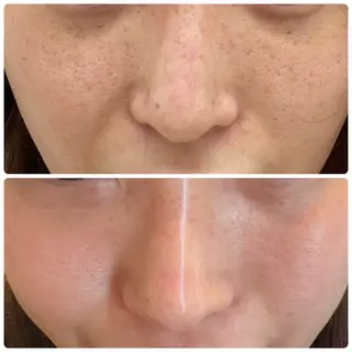 TRUE CARE所属・ハーブピーリング/ 上本町/美肌/幹細胞のエステ・リラクイメージ