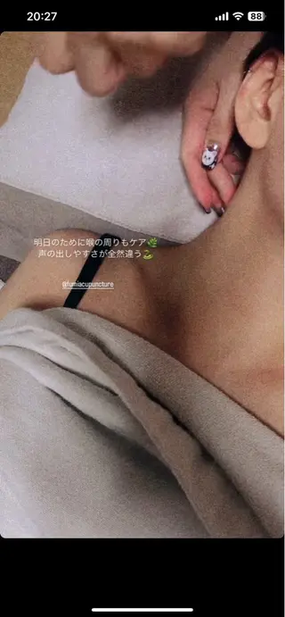 THE  ROOTS所属・美容鍼♡小顔矯正♡ fumikaのエステ・リラクイメージ