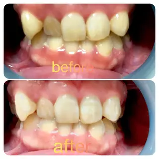 two nailのネイルデザイン