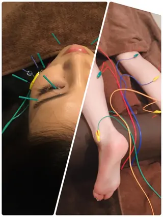 表参道鍼灸院K 美容鍼🔮ララピールのエステ・リラクイメージ