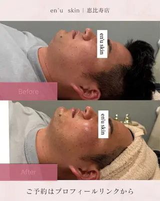 メンズ relaxation salon en'u所属・en'u natsumiのエステ・リラクイメージ