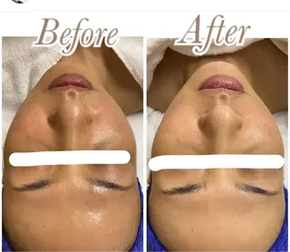 ビューティーサロン　プリズム所属・久留本 茜のエステ・リラクイメージ