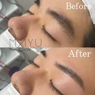 メンズ アイブロウ メンズ眉毛サロン マユクリア大阪梅田店所属・マユクリア 大阪梅田店の眉毛・アイブロウイメージ