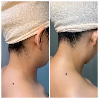 【ハーブピーリング】 Allumentのエステ・リラクイメージ