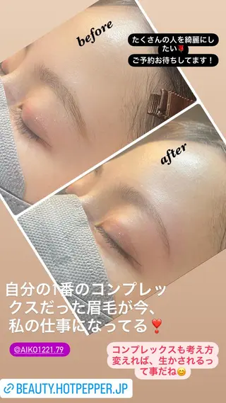 アイブロウ ハーブピーリング/韓国肌管理/フェイシャル/毛穴洗浄/眉毛/顔脱毛【糸脱毛専門】rev所属・ハーブピーリング🌹 毛穴洗浄❤️眉waxのエステ・リラクイメージ