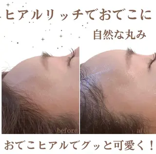 小顔/たるみ/黒ずみ除去専門サロン/SONA 大和西大寺店所属・【小顔専門看護師 サロンSONA】のエステ・リラクイメージ