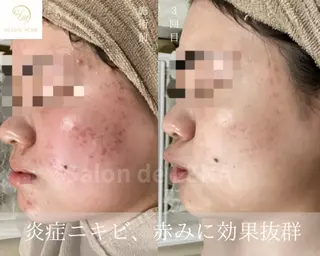 サロンドレナ名駅店所属・ハーブピーリング専門 サロンドレナ平岡のエステ・リラクイメージ