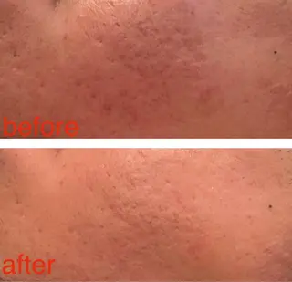 Espoir /エスポワール所属・三澤 秀基のエステ・リラクイメージ