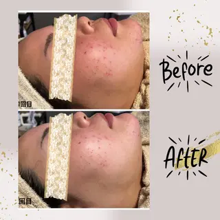 ピーリング専門店 Belluteのエステ・リラクイメージ