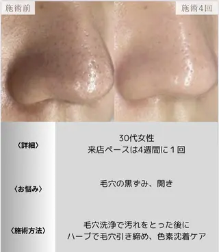 脱毛・眉毛・フェイス サロンN久留米店の眉毛・アイブロウイメージ