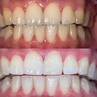 セルフホワイトニングビューティー三川店所属・中村 江梨香のその他イメージ