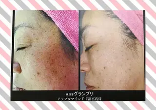 フェイシャルエステ écruのエステ・リラクイメージ