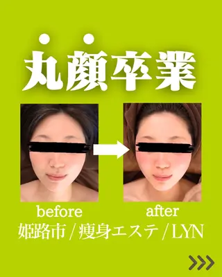 脱毛・痩身専門サロン LYN【リン】のエステ・リラクイメージ