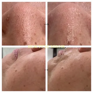 ビューティー ミロワールのエステ・リラクイメージ