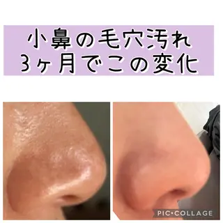 メナードフェイシャル サロンmakiのエステ・リラクイメージ