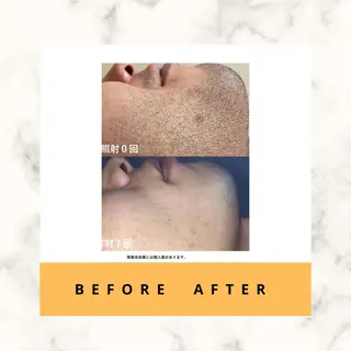 脱毛/痩身/頭皮ケア GLYCINEのエステ・リラクイメージ