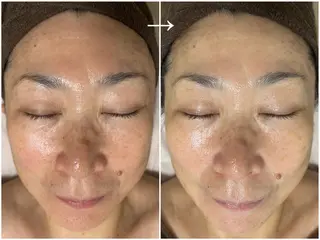 デアイム高島平所属・兼松 美香のエステ・リラクイメージ