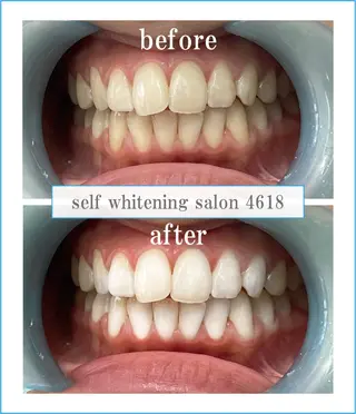 self whitening salon 4618所属・ホワイトニングサロン 4618のその他イメージ
