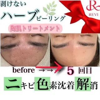 laluna saki...のその他イメージ