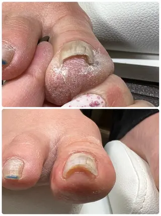 ネイル ___ yuriのネイルデザイン