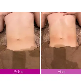 ☆痩身/小顔☆ ハイパーナイフexのエステ・リラクイメージ