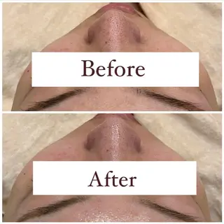 ハーブピーリング専門 muro.のエステ・リラクイメージ