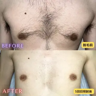 メンズ 都度払い専門　脱毛サロンHYGIENE BEAUTY ROOM 19B 仙台駅前東口店所属・脱毛サロン 19B(毛利)のエステ・リラクイメージ