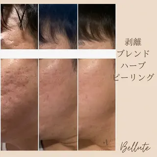 ピーリング専門店 Belluteのエステ・リラクイメージ