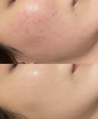 OPREA 千種店のエステ・リラクイメージ