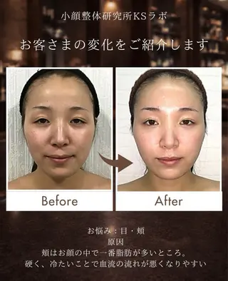 KSラボ自由が丘店所属・小顔整体研究所 KSラボ自由が丘店のエステ・リラクイメージ
