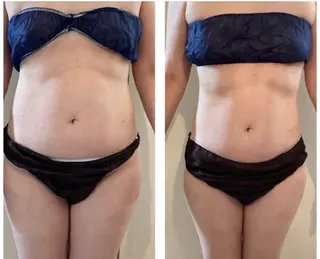 アラカキ サツキのエステ・リラクイメージ