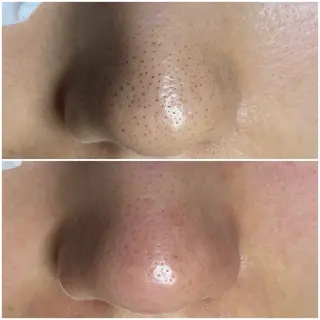 毛穴専門店RANA所属・毛穴専門店【各務原】 天使の毛穴のエステ・リラクイメージ