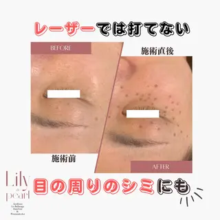 最新シミケアLily de pearlのエステ・リラクイメージ