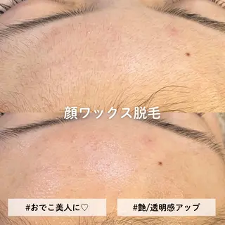 EST BEAUTY所属・顔ワックス脱毛/ ハーブピーリングのエステ・リラクイメージ