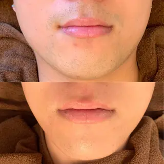 メンズ メンズ脱毛Kyle.横浜所属・メンズ脱毛•眉毛 サロンKyle.横浜の眉毛・アイブロウイメージ