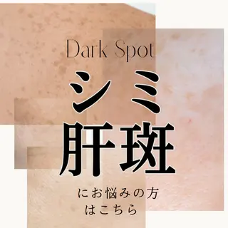 シミ毛穴ケア EsteAのエステ・リラクイメージ