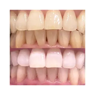 ＬａＬｕｎａ🌙 natsukiのネイルデザイン