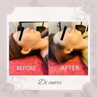 美肌フェイシャル・美肌脱毛 Di cuore所属・美肌専門 Di  cuoreのエステ・リラクイメージ