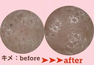 ＲＩＯＮ 〜リオン〜 ／    肌育サロンのエステ・リラクイメージ