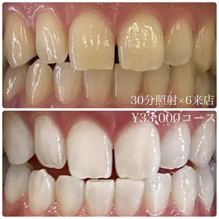 PLATINUM Beauty 横浜店所属・ホワイトニングルーム 横浜店のその他イメージ