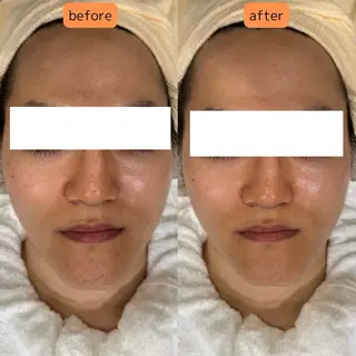 pansy(パンジー)上野フェイシャルエステ専門店所属・pansy saraのエステ・リラクイメージ