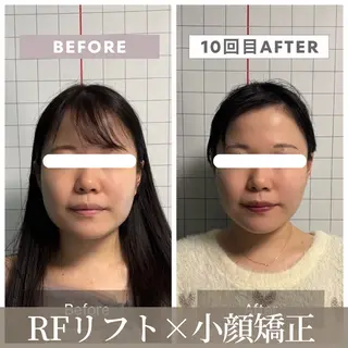 小顔矯正専門店 【RED】池田のエステ・リラクイメージ