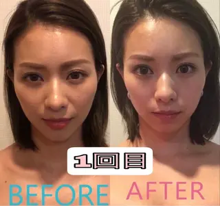 美容鍼灸サロン mahoroba院長のエステ・リラクイメージ