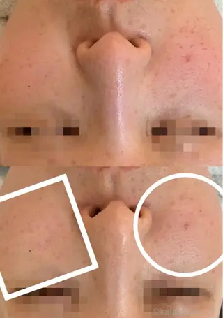 肌質改善 KALANCHOEのエステ・リラクイメージ